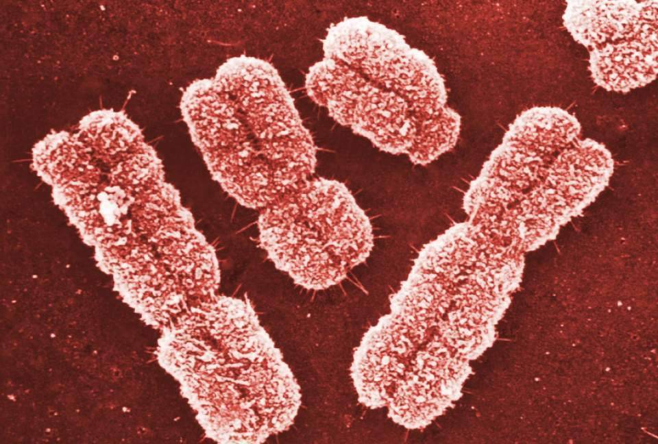 gene expression show promise for autism1